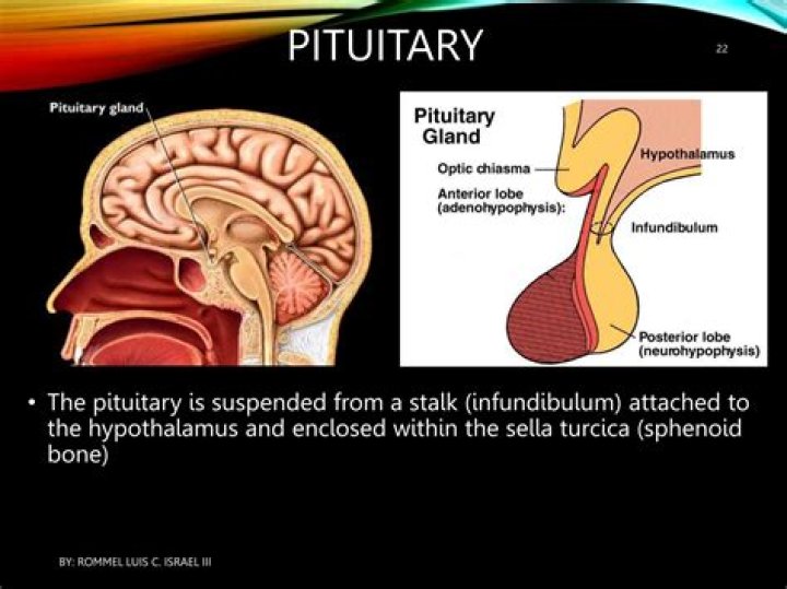 19 Mind-blowing Facts About Pituitary Stalk (Infundibulum)