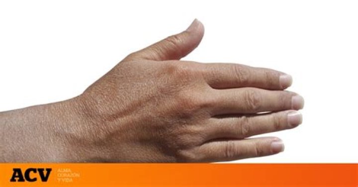 4 problemas de tener la piel seca y que revelan algo mucho peor