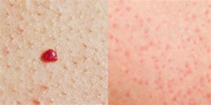 5 Common Causes Of Bumps, Red Spots & Skin Rashes, According To Traditional Chinese Medicine (TCM) | Paige Apgar