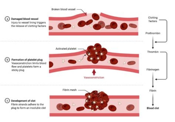 5 Habits That Could Trigger Blood Vessels Rupture