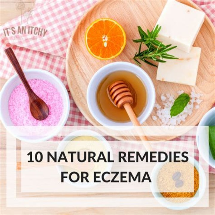 6 Natural Remedies for Eczema Relief