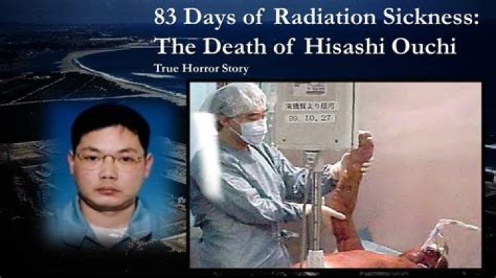83 Days Of Hisashi Ouchi: A Gripping Tale Of Survival And Tragedy
