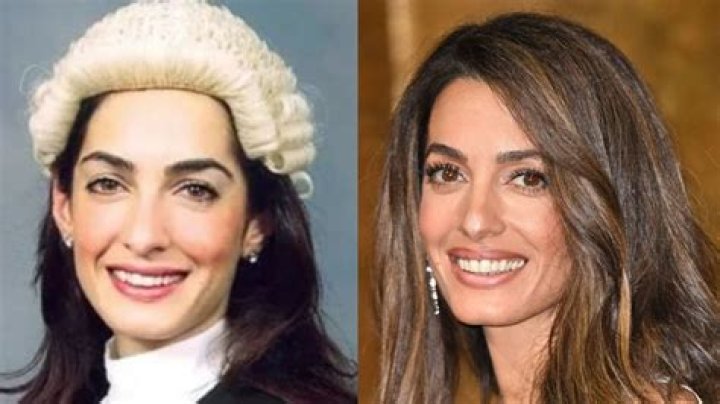 Amal Clooney Plastic Surgery: Unveiling The Truth Behind The Rumors