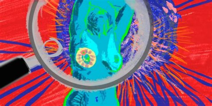 Anticipating Breakthroughs at SABCS 2023