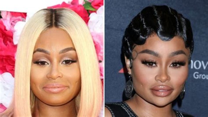 Blac Chyna Plastic Surgery: New Photos Of The Model Suggest She Got Major Work Done To Her Face