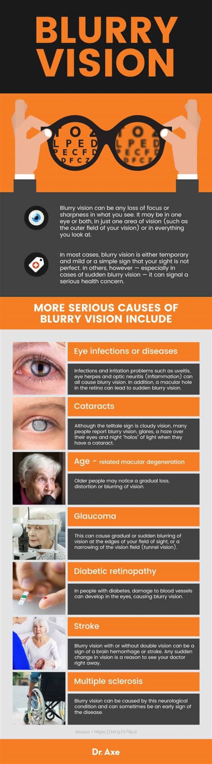 Blurry vision | Causes & treatments of blurred eyes