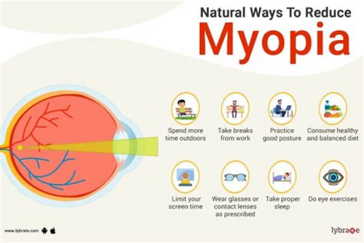 Can You Prevent Myopia?