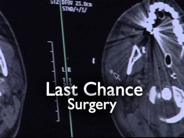 CNN - Last-chance surgery reshapes the heart