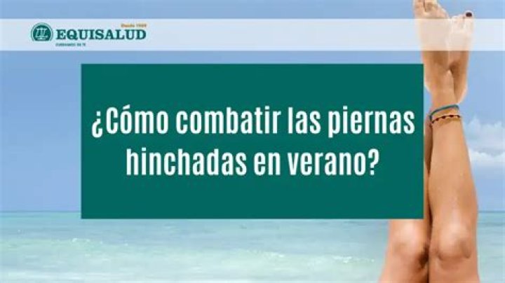 Cómo combatir las piernas hinchadas en verano