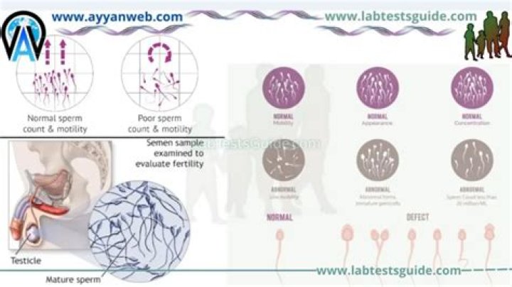 Do Laptops Damage Men's Sperm and Balls? Doctors Explain
