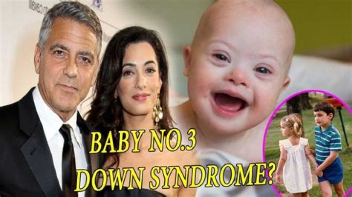 Does George Clooney's Son Have Down Syndrome? Understanding The Facts