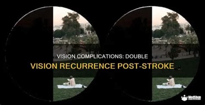Double Vision After a Stroke