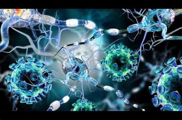 El virus que provoca la mononucleosis podría ser la causa principal de la esclerosis múltiple