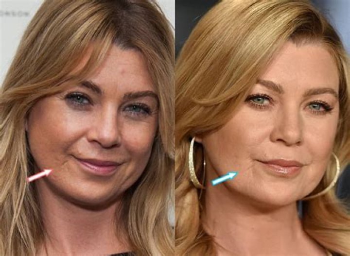 Ellen Pompeo And Plastic Surgery: What You Need To Know