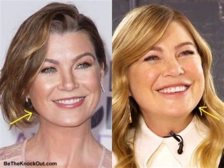 Ellen Pompeo Botox: A Deep Dive Into The Iconic Actress's Beauty Journey