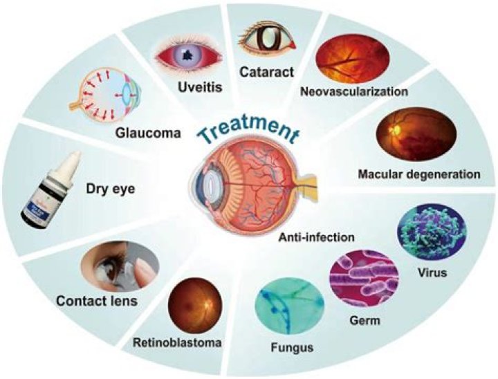 Eye Conditions & Diseases