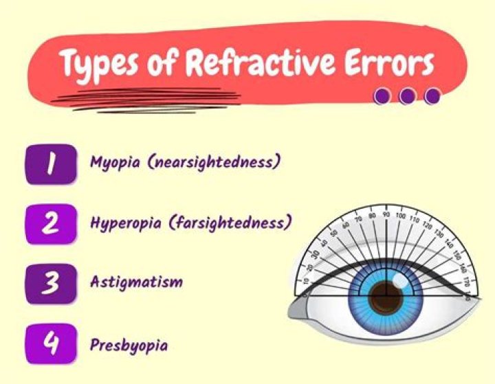 Eye Conditions Guide, Refractive Errors