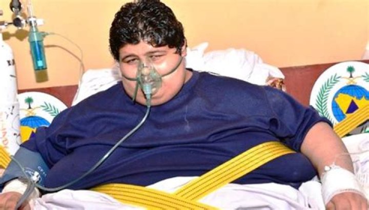 Fattest Person 2024: Exploring The Journey And Challenges Of Extreme Obesity
