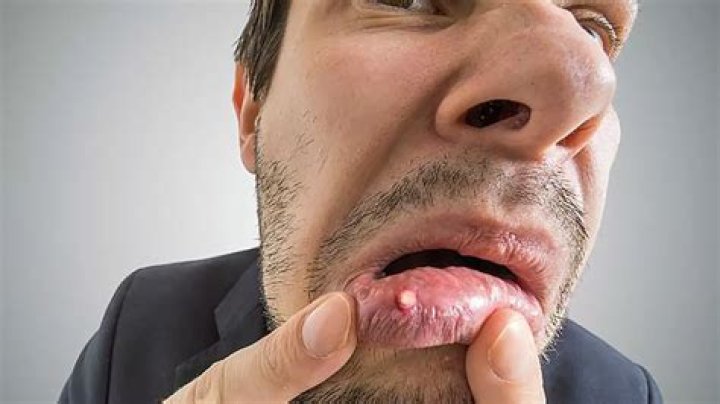 guerra a un enemigo menor pero doloroso