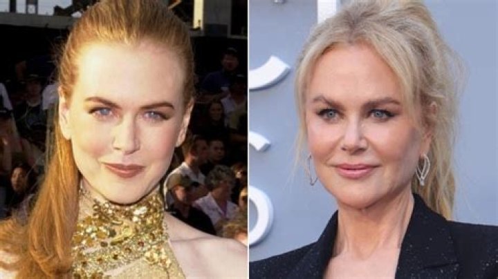 Has Nicole Kidman Had Plastic Surgery? A Comprehensive Analysis