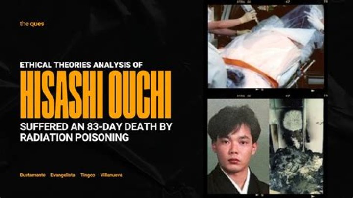 Hisashi Ouchi After Radiation: A Deep Dive Into His Story And Images