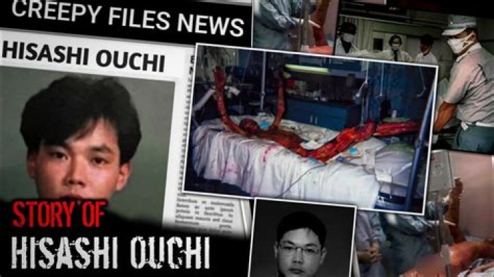 Hisashi Ouchi: The Face Behind A Tragic Nuclear Accident