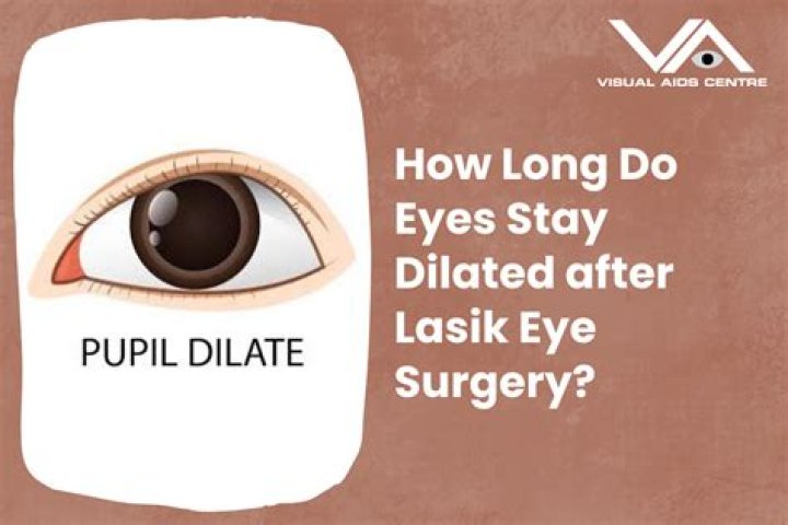 How Long Do Eyes Stay Dilated?