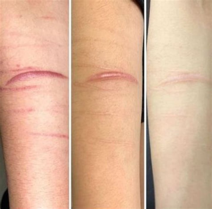 How My Tattoo Saved Me From A Life Of Self-Harm