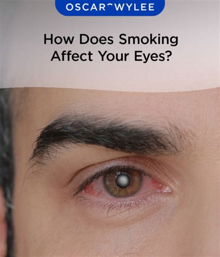 How Smoking Harms Your Eyes