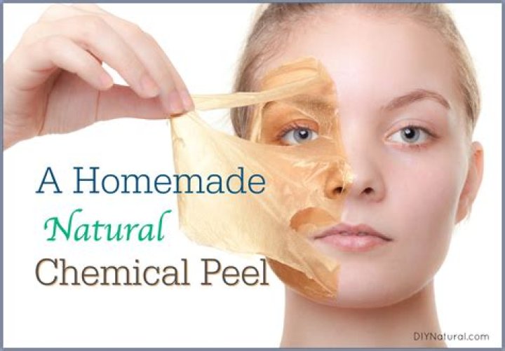 How to Do Your Own At-Home Chemical Peel