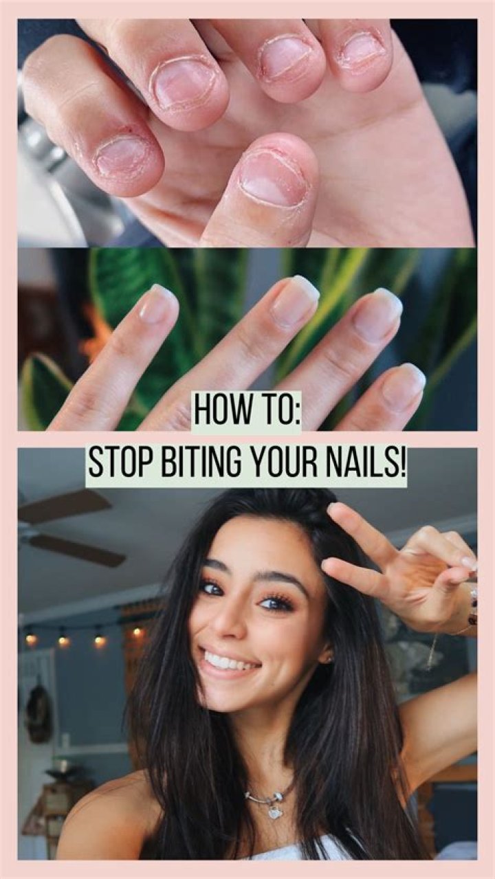 How To Stop Biting Your Nails — For Good