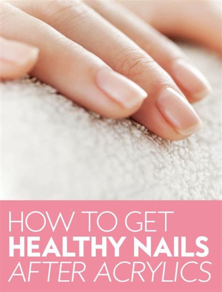 How to Treat Damaged Nail Beds After Acrylics