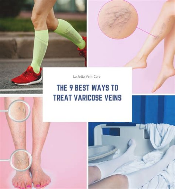 How To Treat Varicose Veins, From Treatments To Makeup