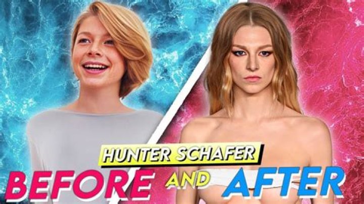 Hunter Schafer's Journey: Understanding Bottom Surgery And Its Impact