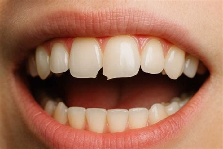 Is broken tooth good in TBC?