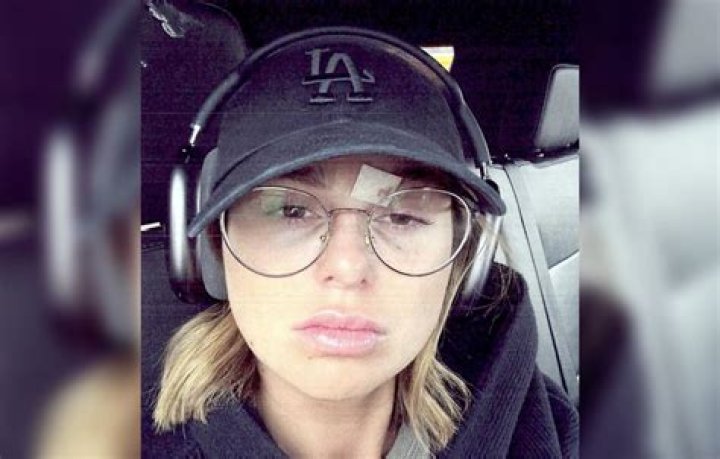 Is Raquel's Black Eye Real? Images Claim 'Vanderpump Rules' Star Lied About Scheana Incident