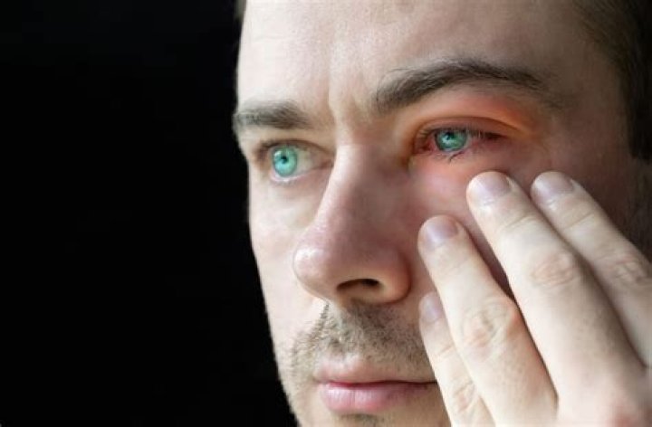 It Feels Like Something Is in My Eye