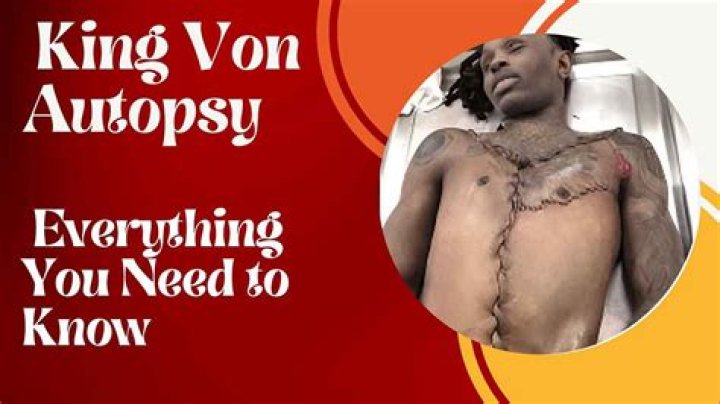 King Von Autopsy Photo: What You Need To Know
