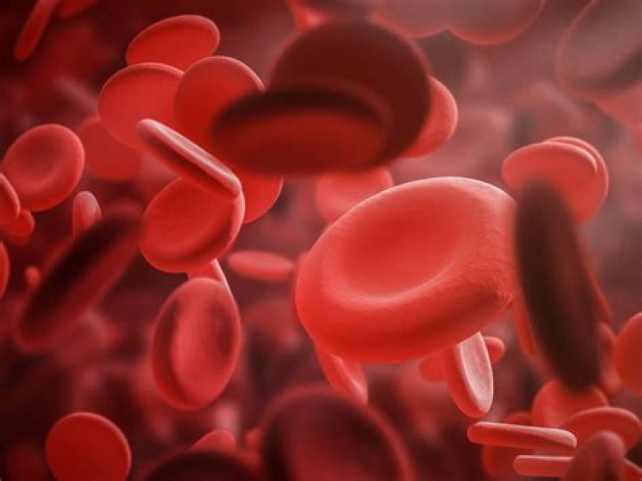 Las causas y síntomas más comunes de la anemia y cómo tratarla