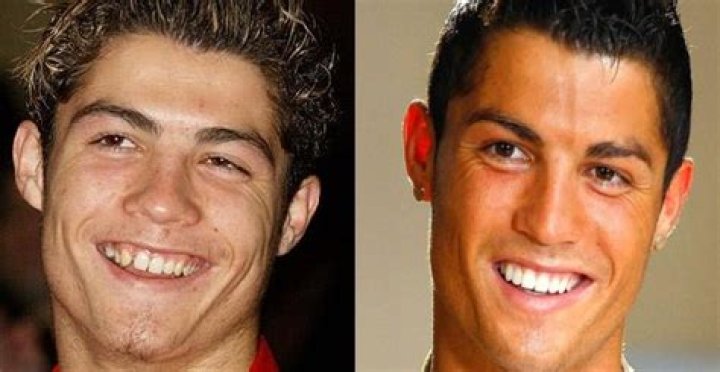 Los dientes de Cristiano - foto 7