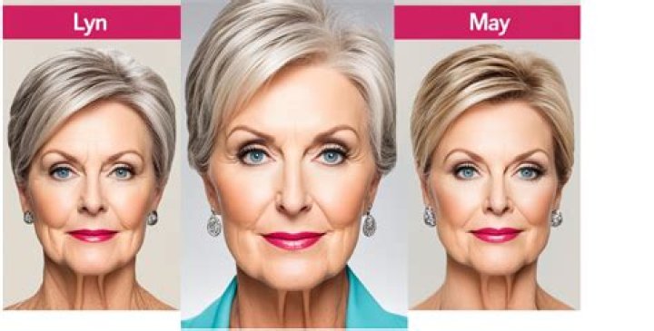 Lyn May Plastic Surgery: A Comprehensive Look At Her Transformation