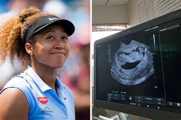 Naomi Osaka Announced She Is Pregnant