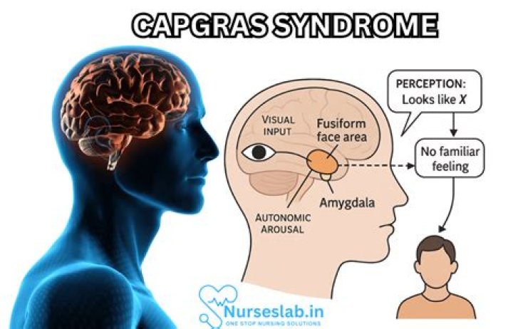 Never Mind – In den Sophiensaelen tanzen sie das Capgras-Syndrom