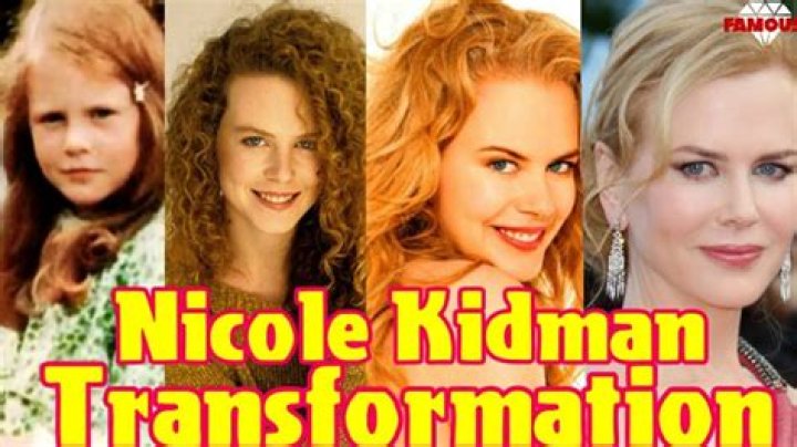 Nicole Kidman: A Profound Transformation In 
