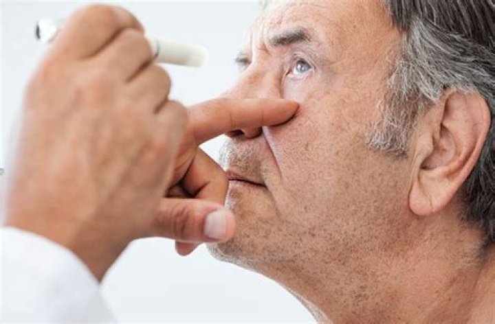 Ophthalmoplegia - All About Vision