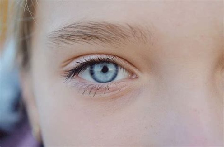 Pupilas pequeñas - All About Vision