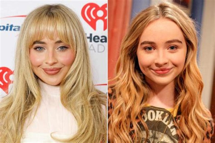 Sabrina Carpenter Fillers: Everything You Need To Know
