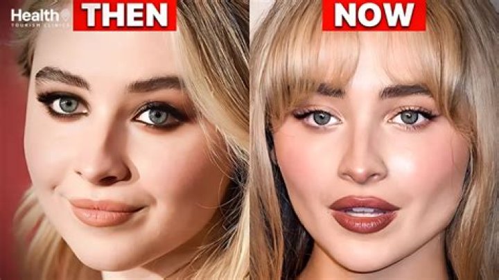 Sabrina Carpenter Plastic Surgery: Truth Behind The Transformation