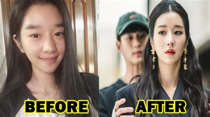 Seo Ye Ji Plastic Surgery: Unveiling The Truth Behind The Transformation