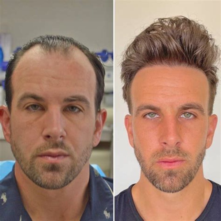 Shoppers Say This $9 Growth Oil Is “Like a Hair Transplant”